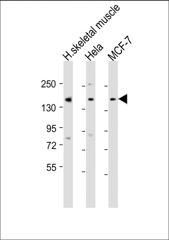 Polyclonal Rabbit anti-Human TNRC6A / GW182 Antibody (aa855-885, WB)