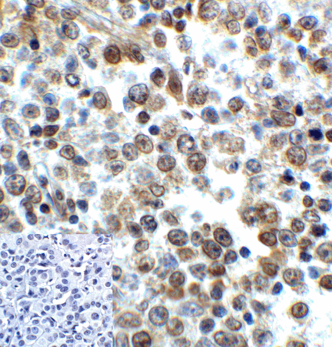 LAG3 Antibody (clone 1G4)