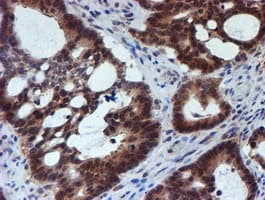TIP48 / RUVBL2 Antibody (clone OTI1D9)