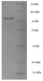 Human NANOG Protein (Recombinant 6His-SUMO, N-terminus)