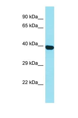Polyclonal Rabbit anti-Human C1orf141 Antibody (aa60-109, WB)
