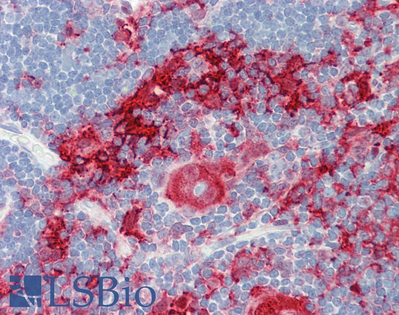 IHC-plus™ Monoclonal Mouse anti-Human GSN / Gelsolin Antibody (clone GEL-42, IHC, WB)