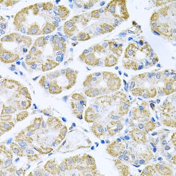 TNFRSF10A / DR4 Antibody