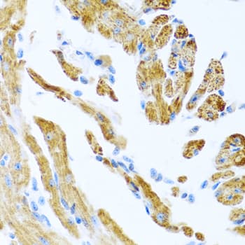 Polyclonal Rabbit anti-Human COL9A3 / Collagen IX Antibody (IHC)