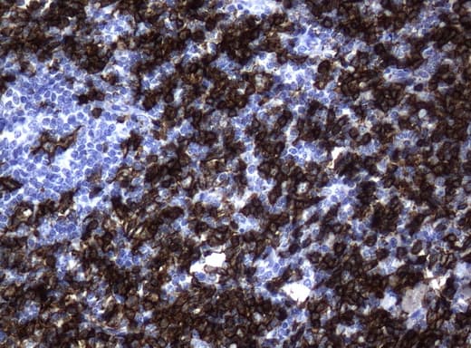 CD20 Antibody (clone UMAB37)