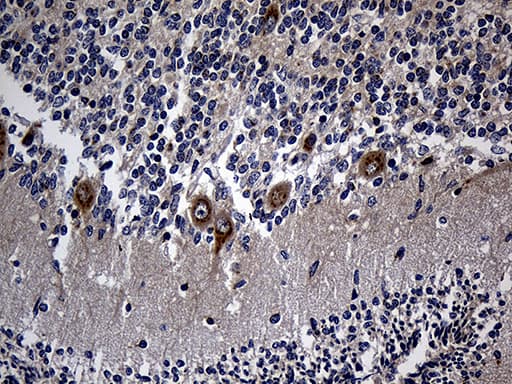RGMA Antibody (aa169-424, clone OTI4G8, Carrier-free)