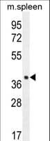 LHFPL5 Antibody (aa186-214)