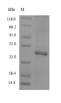 Rat Mast Cell Protease 2 [Mus musculus] Protein (Recombinant 6His, N-terminus + Myc, C-terminus)