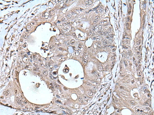 TPT1 / TCTP Antibody