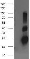 IHC-plus™ TCL / RHOJ Antibody (clone 1D7)