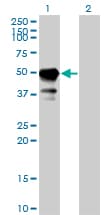 STAM1 / STAM Antibody (clone 2B11-1G1)