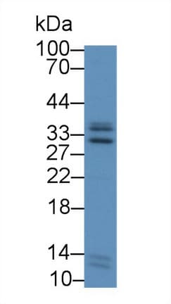 ICAM4 / CD242 Antibody (aa52-234, Cy3)