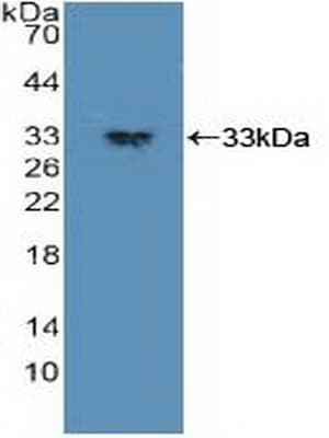 PDPK1 / PDK1 Antibody (aa83-338)