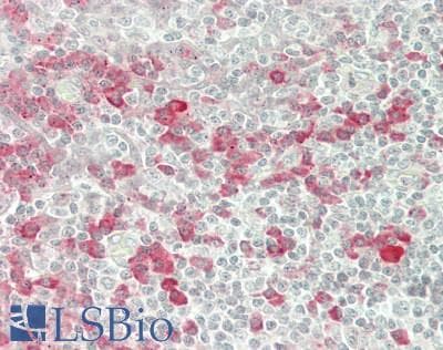 IHC-plus™ Polyclonal Rabbit anti-Human UTP14A Antibody (Internal, IHC, IF, WB)