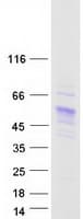 Human Carboxylesterase 5A / CES5A Protein (Recombinant Myc-DDK (Flag))