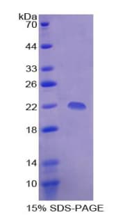 Human DR1 / NC2 Protein (Recombinant His-T7)