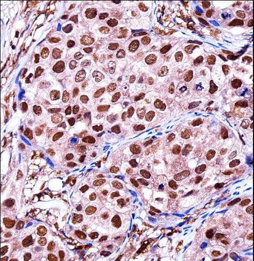 Polyclonal Rabbit anti-Human ZBTB7A / Pokemon Antibody (aa514-542, IHC, WB)