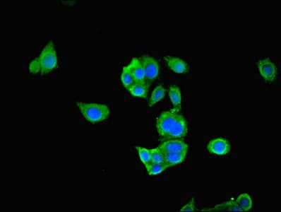 PDHA1 / PDH E1 Alpha Antibody