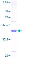 Human HBG1 / Fetal Hemoglobin Protein (Recombinant GST)