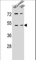 Polyclonal Rabbit anti-Human PRSS55 Antibody (aa289-318, WB)