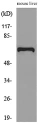 Alpha-Fetoprotein Antibody