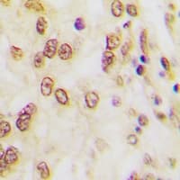 FOSB Antibody