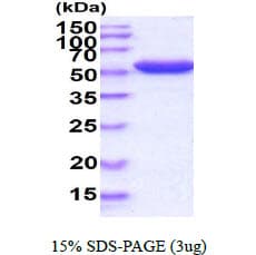 E. coli G6PD Protein (Recombinant)