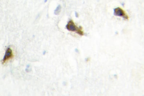 HARS Antibody (Glu492)