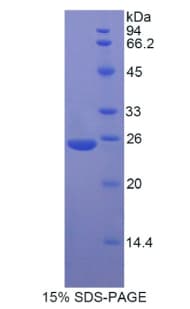 Rat MYH8 Protein (Recombinant His)