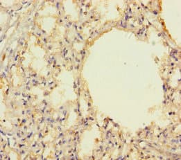 Polyclonal Rabbit anti-Human PRKRIR Antibody (WB)