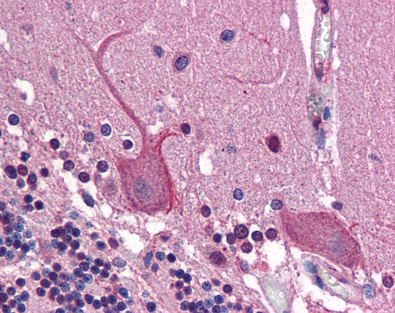 Polyclonal Rabbit anti-Human AP1G1 / Adaptin Gamma 1 Antibody (aa574-623, IHC, WB)