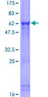 Human RGN / Regucalcin Protein (Recombinant GST)