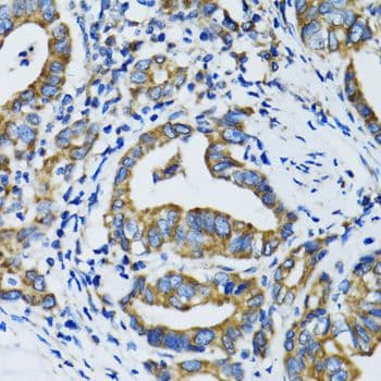 STAT3 Antibody