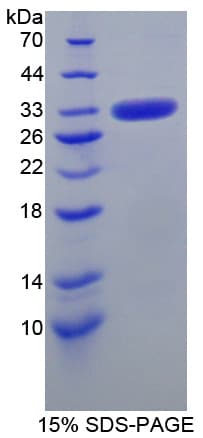 Human CA-VB / CA5B Protein (Recombinant His-T7)