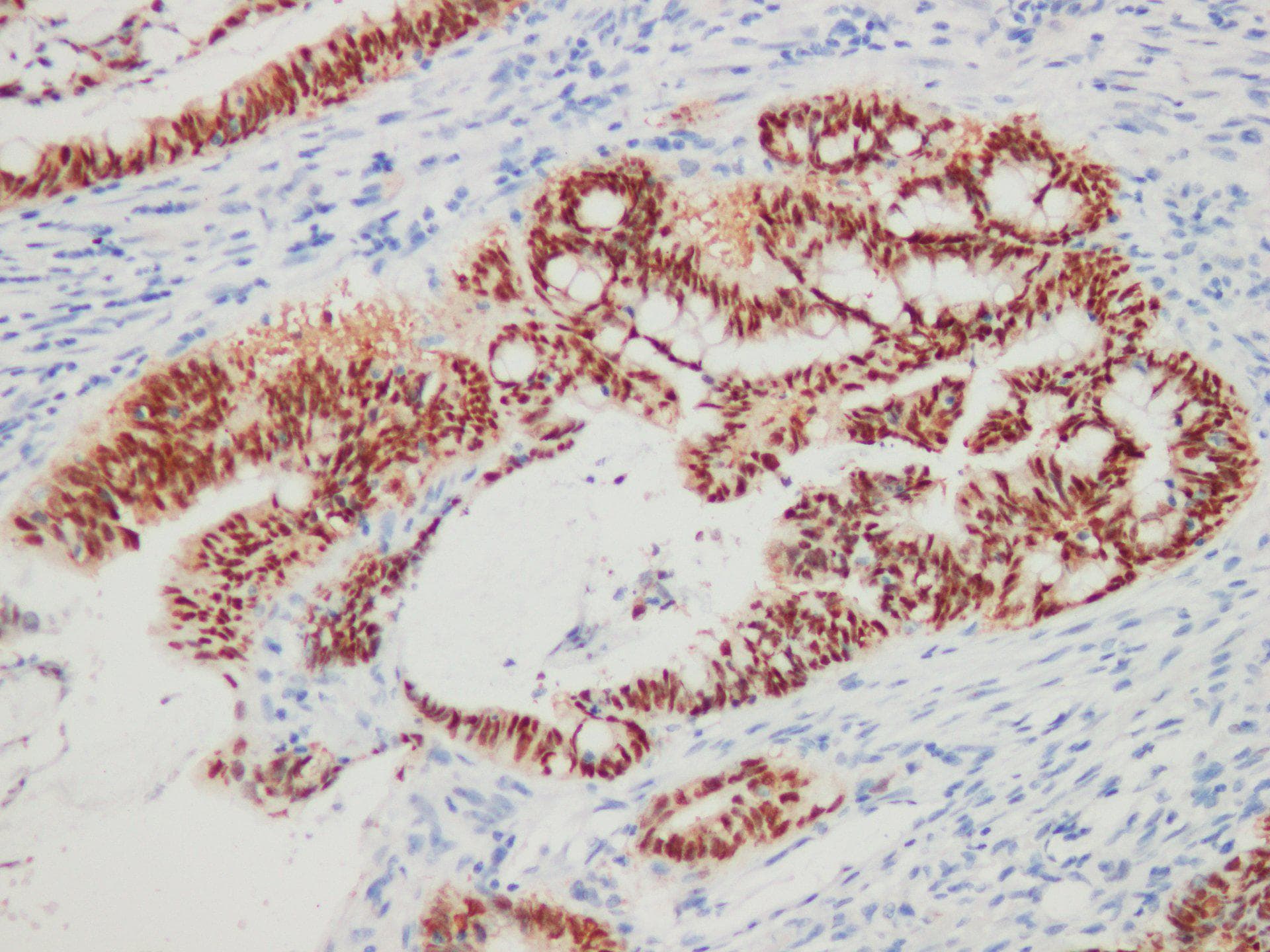 CDX2 Antibody