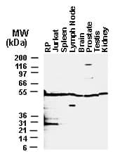 BAR / BFAR Antibody (aa1-139)