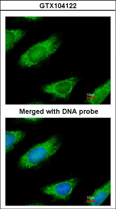 ME1 / Malate Dehydrogenase Antibody (aa161-519)