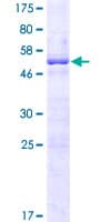 Human TCP10L Protein (Recombinant GST)