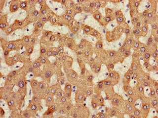 Carboxylesterase 1 / CES1 Antibody