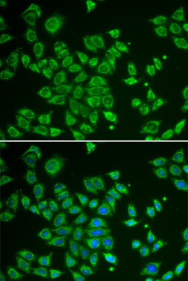 SMAD1 Antibody