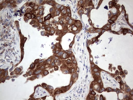 Monoclonal Mouse anti-Human POMK / SGK196 Antibody (clone OTI1B1, aa141-350, IHC, WB)