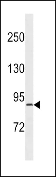 Polyclonal Rabbit anti-Human RPS6KA4 / MSK2 / RSK-B Antibody (aa481-508, WB)