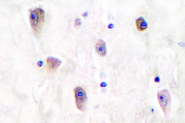 GRIK1 / GLUR5 Antibody (Leu12)