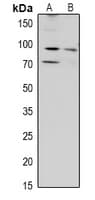 Polyclonal Rabbit anti-Human ZAK / MLTK Antibody (WB)