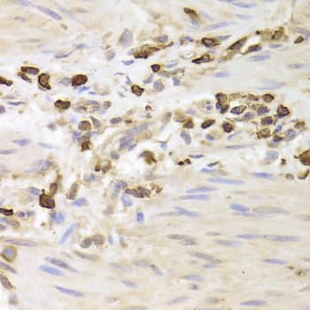 Polyclonal Rabbit anti-Human LSP1 Antibody (IHC, WB)