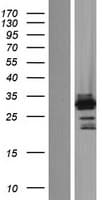 OSR2 Protein (Over-Expression Lysate Myc-DDK (Flag))
