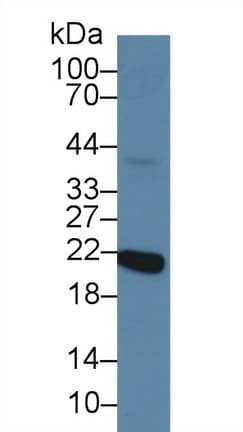 Recoverin Antibody (aa2-200, Biotin)