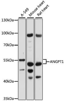 Polyclonal Rabbit anti-Human ANGPT1 / Angiopoietin-1 Antibody (WB)