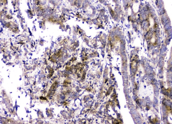 RMI2 / C16orf75 Antibody