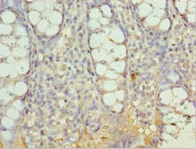 Polyclonal Rabbit anti-Human AIMP2 Antibody (aa141-320, IHC, WB)